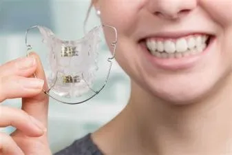 How much should i ask for as a retainer?