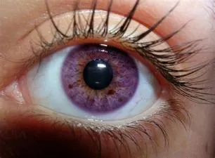 What are the rarest real eye colors?